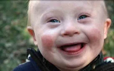 Down Sendromu Riski Riskleri ve Sonrası